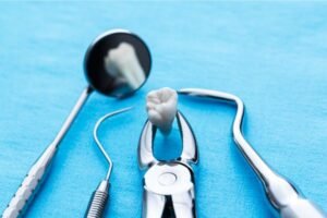 Instrumentos odontológicos, incluindo fórceps segurando um dente extraído, espelho e sonda exploradora, dispostos sobre uma superfície azul, representando o procedimento de extração de dente.