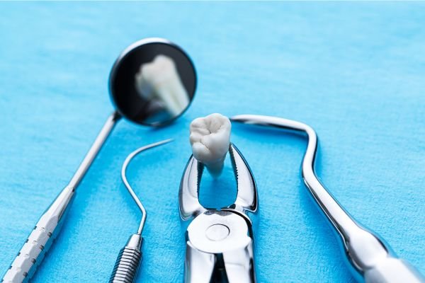 Instrumentos odontológicos, incluindo fórceps segurando um dente extraído, espelho e sonda exploradora, dispostos sobre uma superfície azul, representando o procedimento de extração de dente.