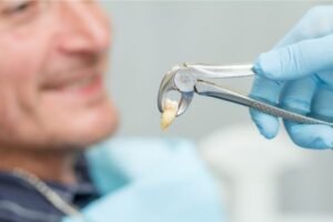 Dentista segurando um fórceps com um dente recém-extraído, enquanto o paciente sorri ao fundo, destacando um procedimento de extração de dente bem-sucedido.