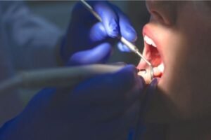 Dentista utiliza instrumentos odontológicos, como espelho e sonda, para examinar a boca de um paciente durante um procedimento sob iluminação direta.
