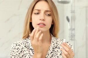 Mulher olhando preocupada para o espelho enquanto aplica um remédio em creme nos lábios, sugerindo tratamento para aftas ou feridas bucais.